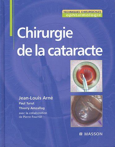 download Cataracte