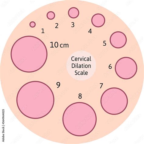 Centimeters Dilated Chart