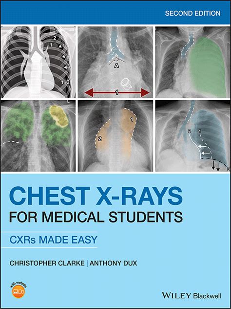 ## Free Chest X-Ray for Medical Students Pdf Books