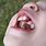 Cleft Palate Teeth