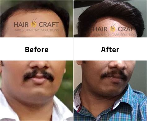 Craft hair fixing anchal