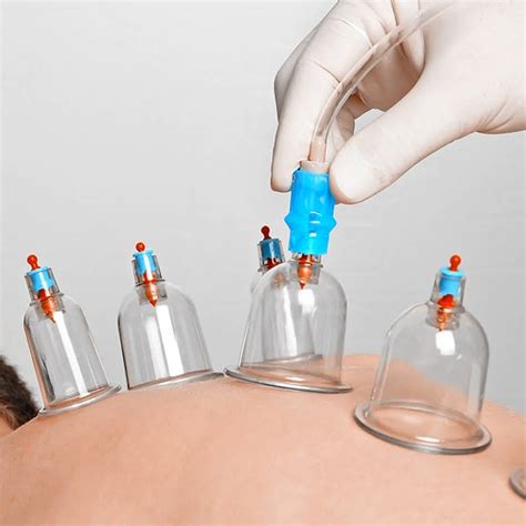 Cupping hijama male only
