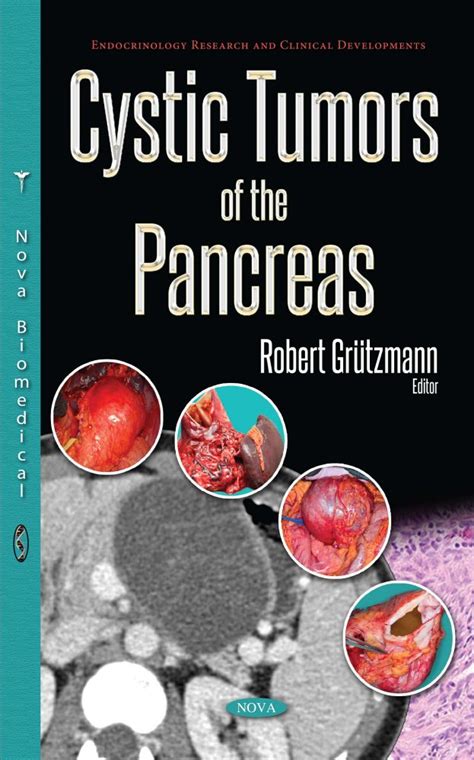 download Cystic Tumors of the Pancreas