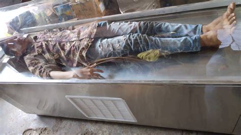 Dead Body Freezer Box in Nallakunta & Kachiguda