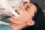 Deep Clean Dental