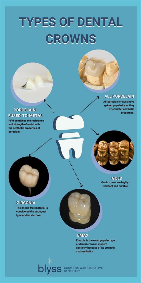 Dental Crown materials chart