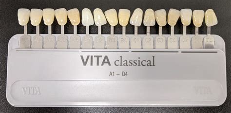 Dental Implant Color Chart
