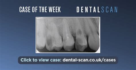Dental Scan Ltd