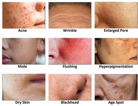 Skin Conditions F… 