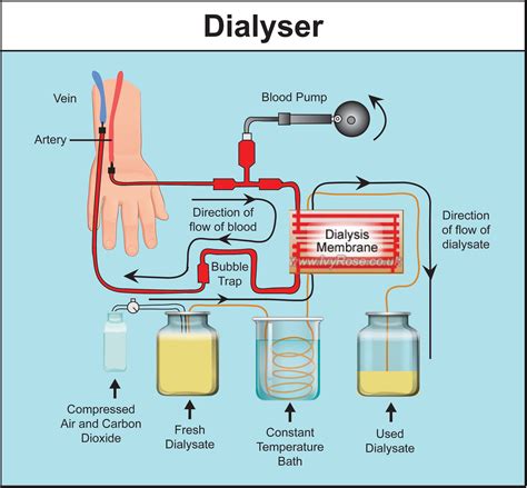 Diffusion During Dialysis