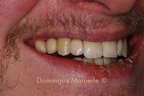 Domingos Mamede Implant Dentist