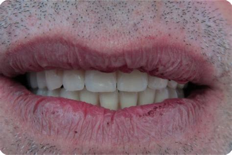 Dr BAROUD Alexandre à Lyon