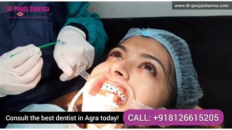 Dr Pooja Sharma - Dentist in Agra | Smile Makeover Teeth Braces Treatment & RCT