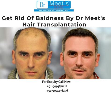 Dr. Meet's Hair & Skin Clinic | Hair Fall & Hair Loss Treatment Indore, Specialist Doctor, Laser Hair Removal, Tattoo Removal