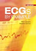 download ECGs by Example