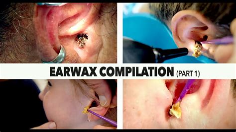 Ear Better Wax Removal & Hearing Care