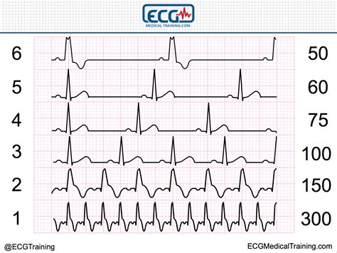 Ecg Heart Rate Chart