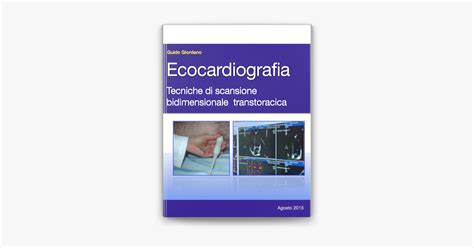 download Ecocardiografia. Tecniche di scansione bidimensionale transtoracica