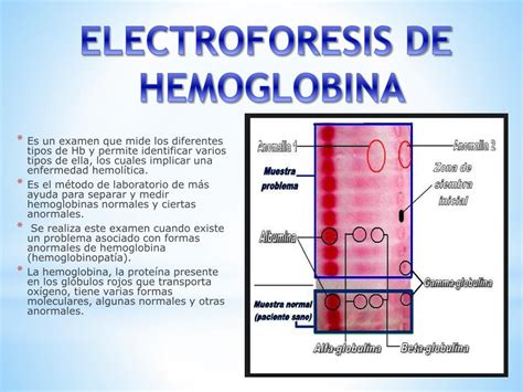 De Hemoglobina