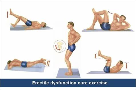 Erectile Dysfunction Cure Exercise: A Comprehensive Guide to Overcoming ED