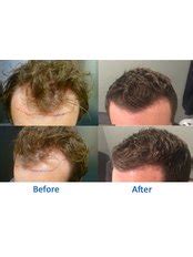 FM Hair Restoration