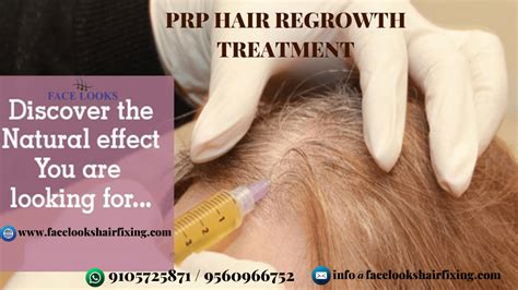 Face Looks Hair Replacement Clinic in Noida