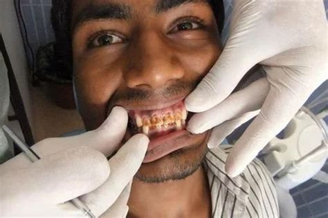 Family Dental Clinic Dr. Ravinder Yadav (Army Dental College)