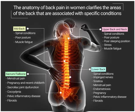 Female Chart Back Pain
