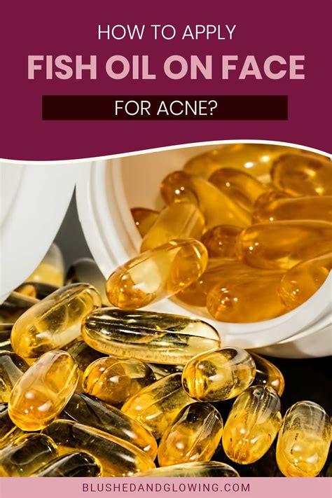Fish Oils for Acne