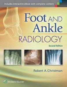 download Foot and Ankle Radiology: Second Edition