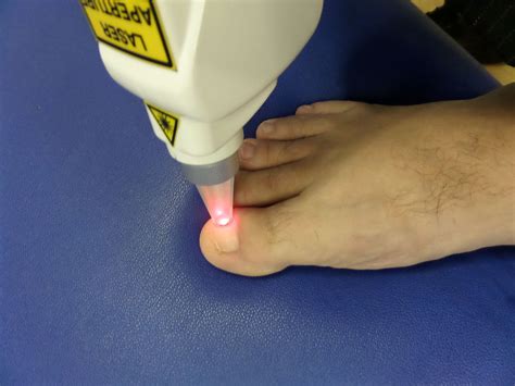 Footsteps Chiropody & Podiatry Practice
