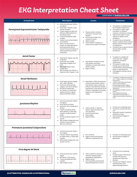 Free Printable Ekg Interpretation Cheat Sheet