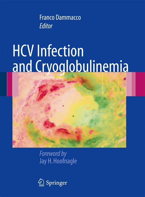 download HCV Infection and Cryoglobulinemia