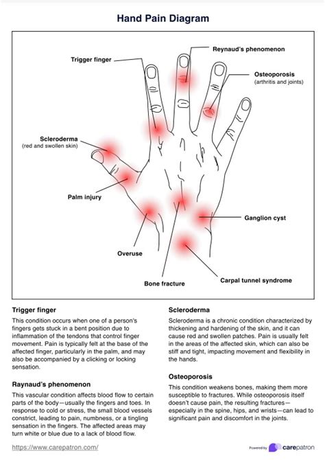 Hand Pain Chart