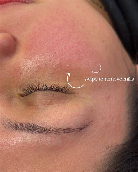 Haven Esthetic & Spa Rotermanni 5, 10111 Tallinn