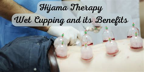 Hijama/wet cupping Therapist