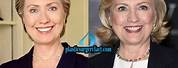 Hillary Rodham Clinton Facelift