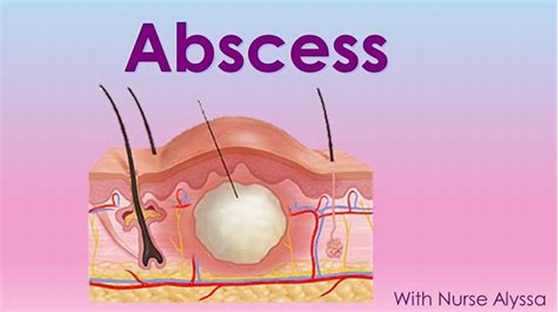 How Abscess Form