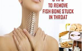 How to Remove Fish Bone Stuck in Throat