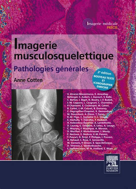 ### Free Imagerie musculosquelettique : pathologies générales Pdf Books