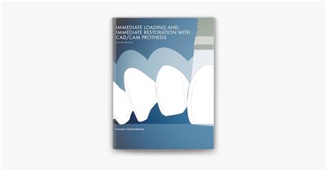 download Immediate Loading and Immediate Restoration with CAD/CAM Prothesis