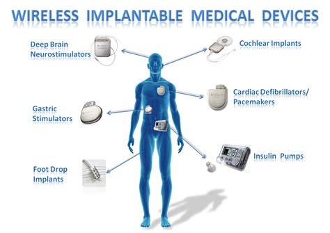 Implantable Medical Devi… 