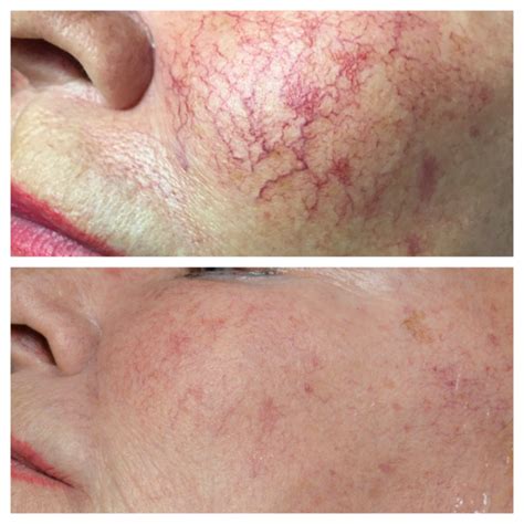 Indulgence Skin Laser & Beauty Clinic