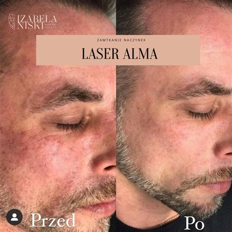 Izabela's Laser &Skin Clinic