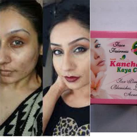 Kanchan Kaya Beauty Parlour