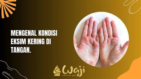 Kulit Tangan Kering