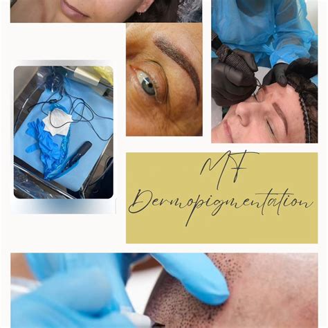 MF Dermopigmentation à Ruffiac
