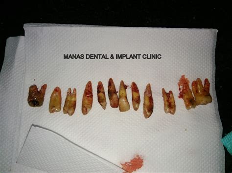 Manas Dental And Implant Clinic