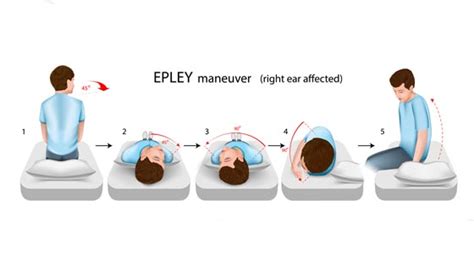 Manuver Epley