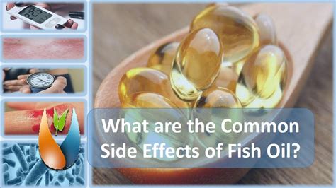 May Increase Risk of Bleeding Side Effect of Fish Oil